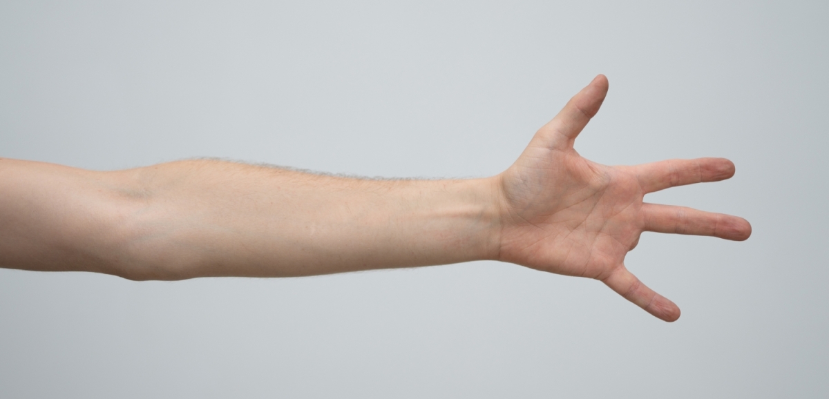 Arm und Hand mit vier Fingern.